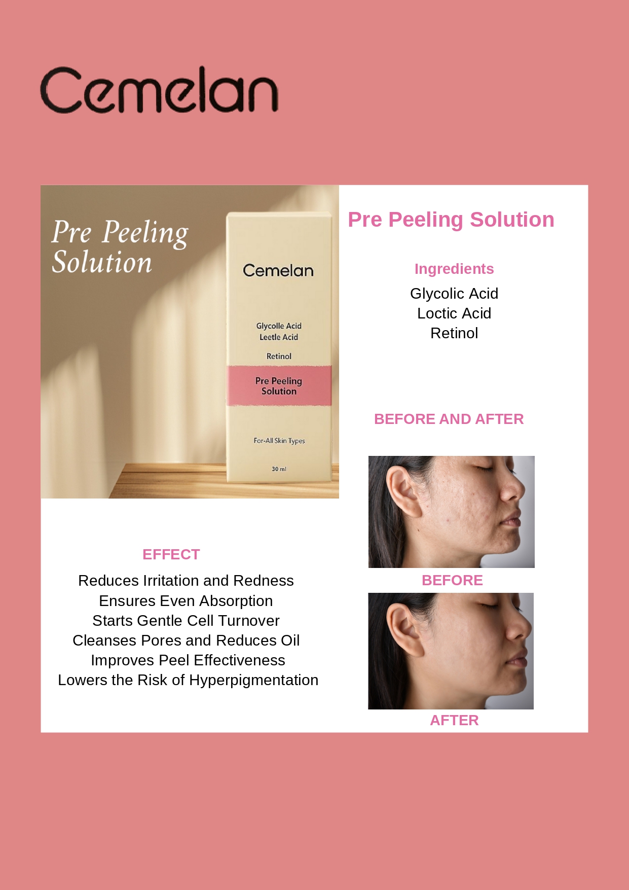 Pre Peeling Solution