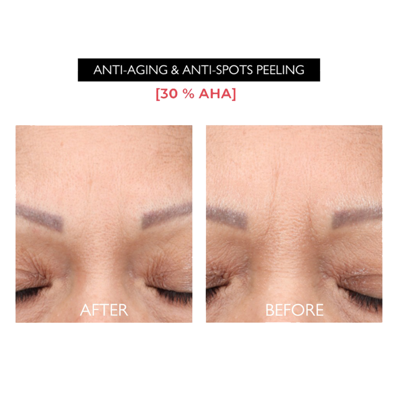Before After- Anti-ageing peel EN